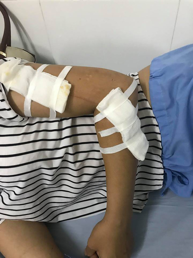 vu an 7 nguoi bi chem o thai nguyen tra thu vat vi bi noi vo no lam an mat kiep