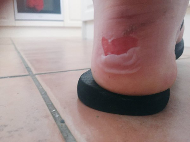 16 noi kho hang ngay cua hoi dan ba con gai ma dan ong co hieu cung chet lien