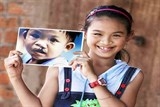 Operation Smile Việt Nam sẽ mang lại hơn 100 nụ cười tháng 11/2017