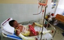 nhac nho chuyen dau o to nguoi phu nu bi hat chao dau soi vao nguoi o tphcm