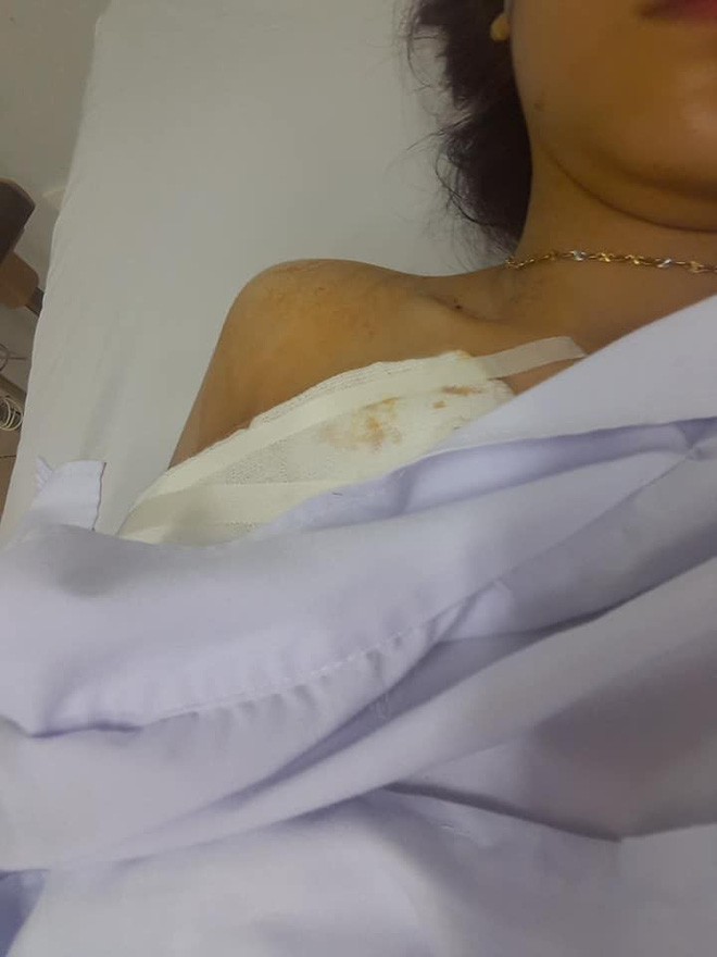 co gai thuat canh lieu mang voi ten cuop mau phun nhu voi rong va nghi van cua dan mang