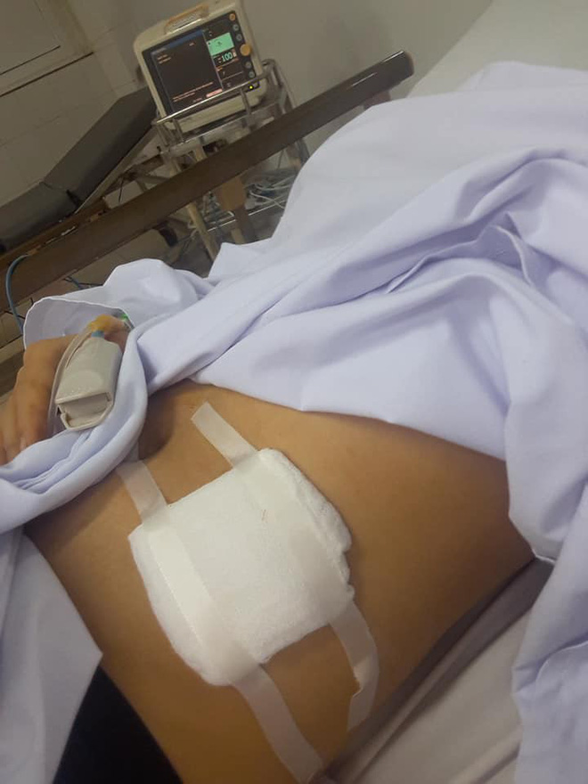 co gai thuat canh lieu mang voi ten cuop mau phun nhu voi rong va nghi van cua dan mang