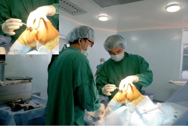 benh vien huyen cu chi lan dau thuc hien thanh cong ky thuat thay khop goi