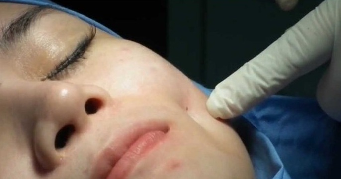 mat bien dang vi tham my theo phong thuy