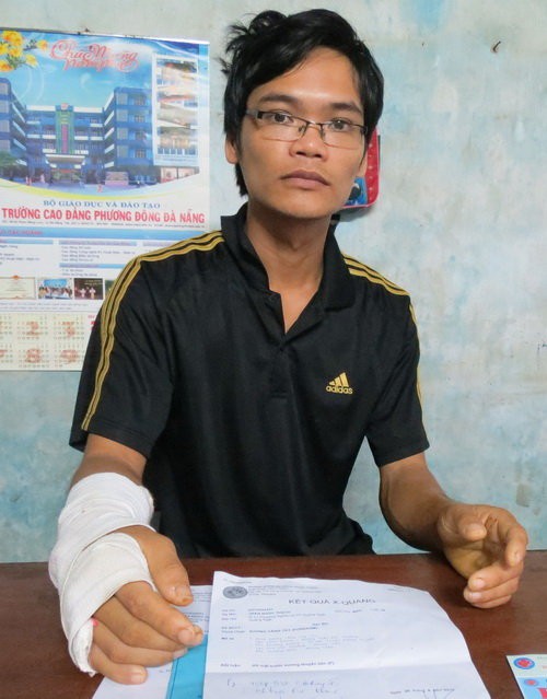 mo nham khong phai chuyen hiem