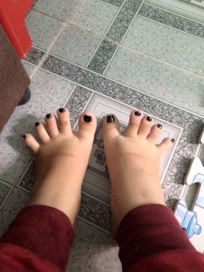 doi ban chan co hinh dang nua nhan sam nua banh my khien cu dan mang thich thu