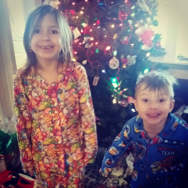 toc con vuong day luoc khi chai me nghi ngo can benh nay va day la chan doan chinh xac cua bac si