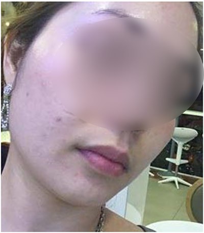 khach hang tung la dai ly cua ts group to bi man ngua khi dung san pham bay gio lien he voi ho nhu di mo kim day be