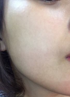 khach hang tung la dai ly cua ts group to bi man ngua khi dung san pham bay gio lien he voi ho nhu di mo kim day be