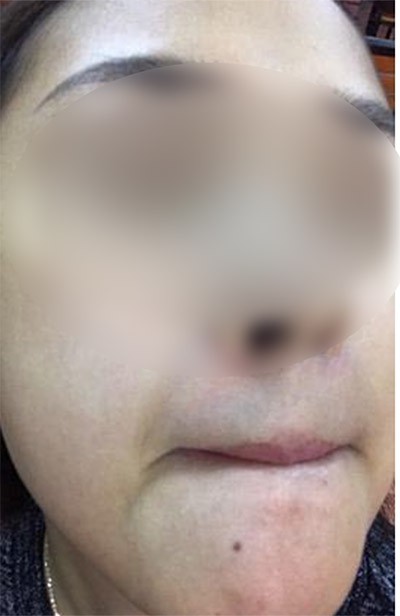 khach hang tung la dai ly cua ts group to bi man ngua khi dung san pham bay gio lien he voi ho nhu di mo kim day be