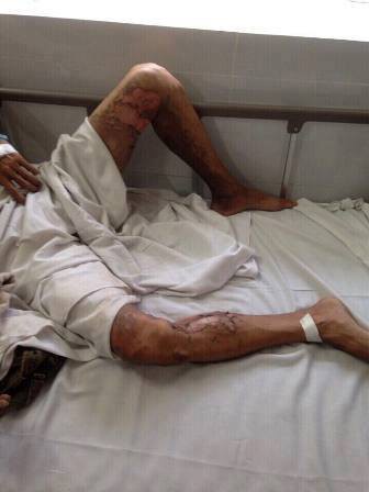 buc tuc vi tra tien thua khong dung nam thanh nien mua xang dot tiem tap hoa o sai gon