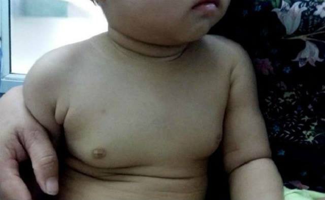 be gai 22 thang tuoi co tuyen vu phat trien lon bac si nghi do me uong thuoc tranh thai trong khi cho con bu