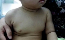 be gai 22 thang tuoi co tuyen vu phat trien lon bac si nghi do me uong thuoc tranh thai trong khi cho con bu