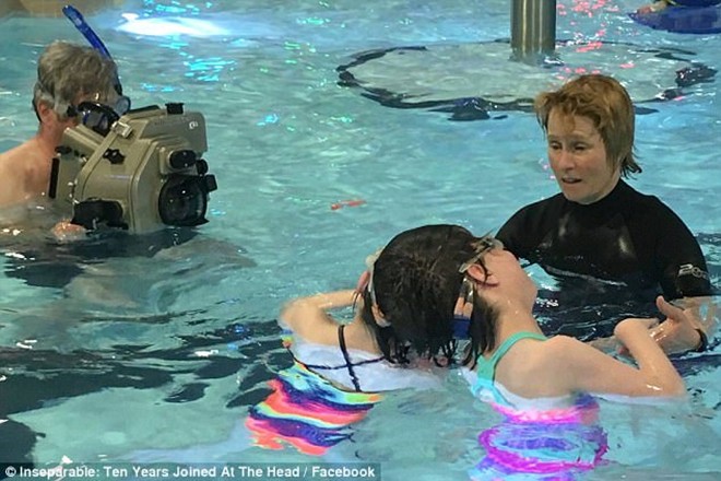 11 nam thang tram cua cap song sinh dinh lien phan dau tung duoc bac si du doan chi song khong qua 1 ngay