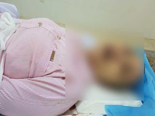 vu mot phu nu bi sat hai voi nhieu vet thuong tren nguoi nan nhan di cung mot nam thanh nien bi an truoc khi tu vong