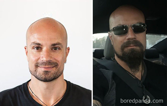 15 anh chang day thi thanh cong sau khi quyet dinh de rau