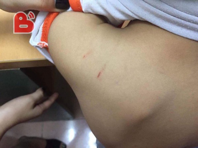 ha noi nghi ngo con bi bao hanh khi song chung voi me ke me de am tham theo doi va quay lai duoc canh tuong dau long