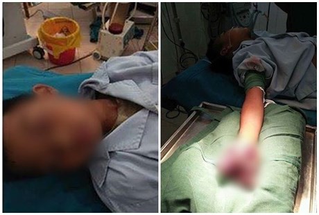 tu cai chet cua nu sinh lop 9 bi dien giat nhung tai nan thuong tam do sac dien thoai va canh bao tu chuyen gia