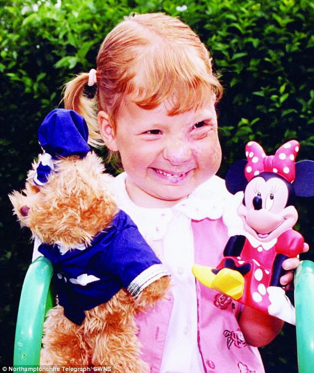 sinh ra voi guong mat bien dang va bi nguoi doi xa lanh phep mau da khien cuoc doi co gai thay doi sau 25 nam