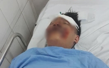 tong trung roi keo le 2 nam sinh dai hoc fpt gan 40m tai xe chay tron bo mac 2 nan nhan nam bat tinh giua duong