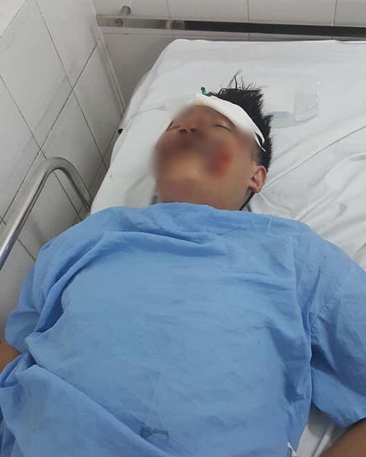 tong trung roi keo le 2 nam sinh dai hoc fpt gan 40m tai xe chay tron bo mac 2 nan nhan nam bat tinh giua duong