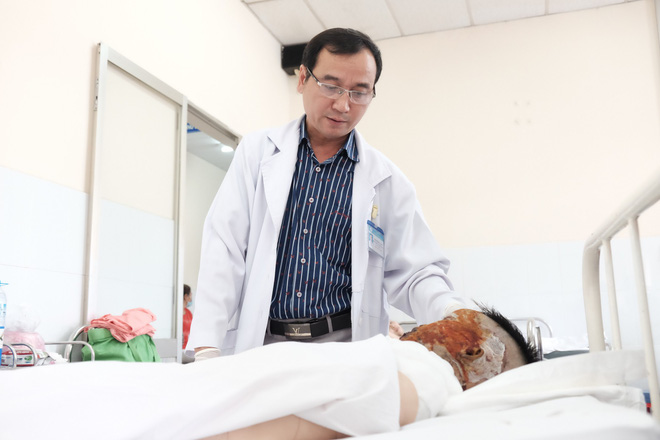 thuong tam thieu nu 17 tuoi bi tat axit huy hoai dung nhan tren duong tan ca lam tro ve
