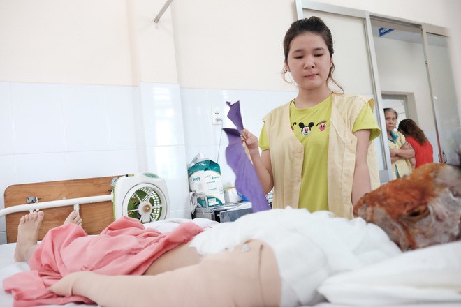 thuong tam thieu nu 17 tuoi bi tat axit huy hoai dung nhan tren duong tan ca lam tro ve