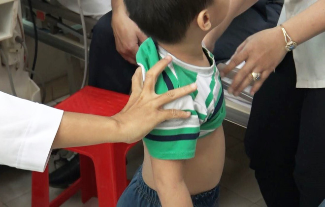 vu bao mau bao hanh tre em tai mam xanh nhieu tre quay khoc mat ngu ve dem tham chi co trieu chung tu ky