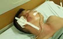 thieu uy bien phong no sung ak vao nhieu dong doi da tu sat mot don pho tu vong