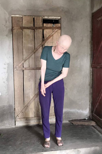 nghe an xot thuong gia canh chong tan tat cham vo ung thu con dinh ruot