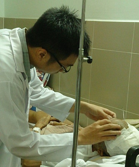 bv tuyen quan mo thanh cong ca chan thuong so nao