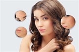 6 điều bạn cần làm để “nói không” với mụn trứng cá