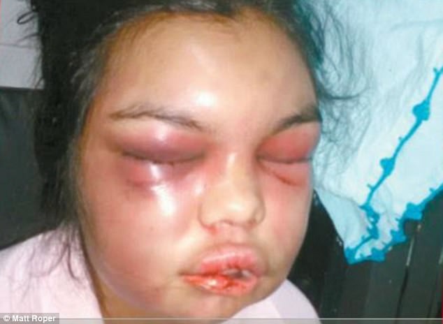 anh tren facebook nhan duoc bao nhieu luot thich vo bi chong danh bay nhieu tran khien phai dap mat di xay lai