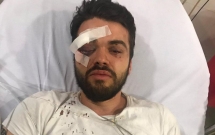 cau thu dong tinh bi dam dong ky thi hanh hung den do mau