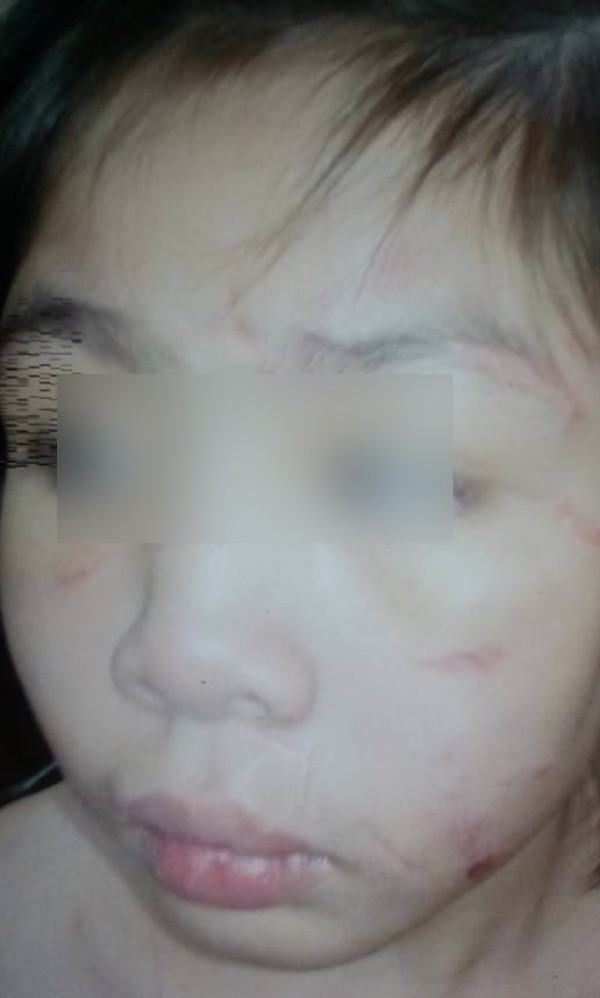 me de be trai nghi bi bo va di bao hanh tan nhan nhin thay be toi khong nhan ra khong tin la con minh