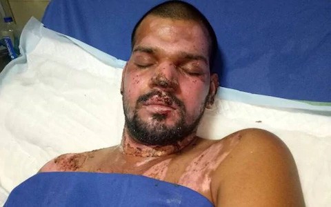 vo sat hai chong roi dung axit huy dung nhan nhan tinh voi am muu hoan doi than phan hai nguoi