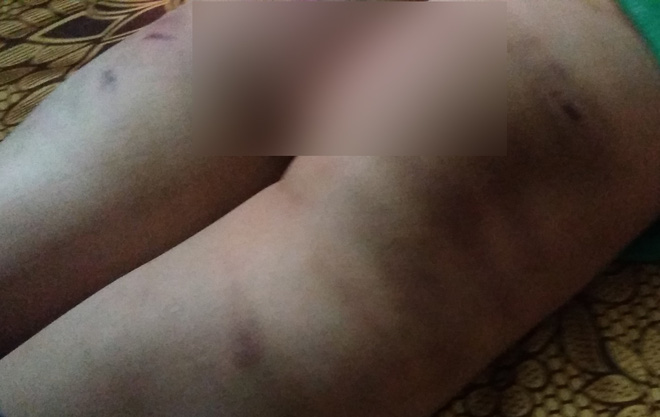 vu be trai bi bao hanh o dong anh ha noi nguoi me lam don xin hoa giai cho chong cu