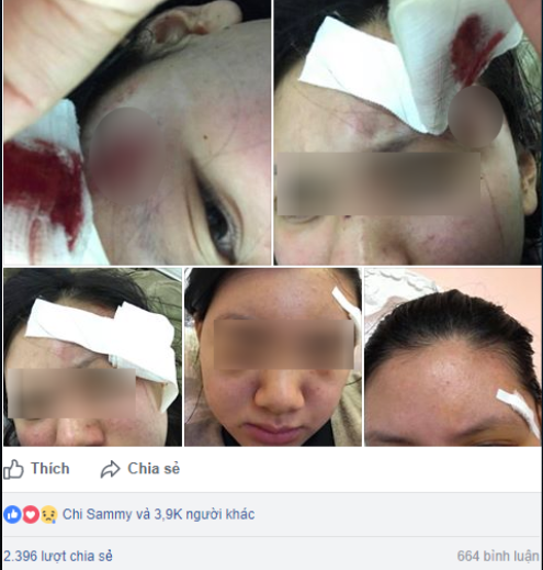 ha noi nguoi vo xinh dep to bi chong danh rach dau mang bau cung hanh hung khong tha