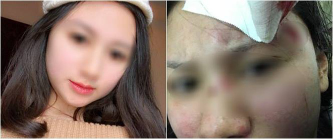 ha noi nguoi vo xinh dep to bi chong danh rach dau mang bau cung hanh hung khong tha