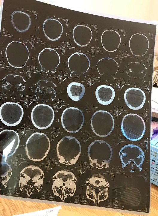 ha noi nguoi vo xinh dep to bi chong danh rach dau mang bau cung hanh hung khong tha