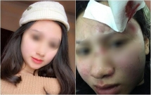 lam gi khi bi chong danh