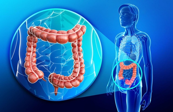 Những phương pháp mới nhất trong điều trị ung thư đại tràng hiện nay