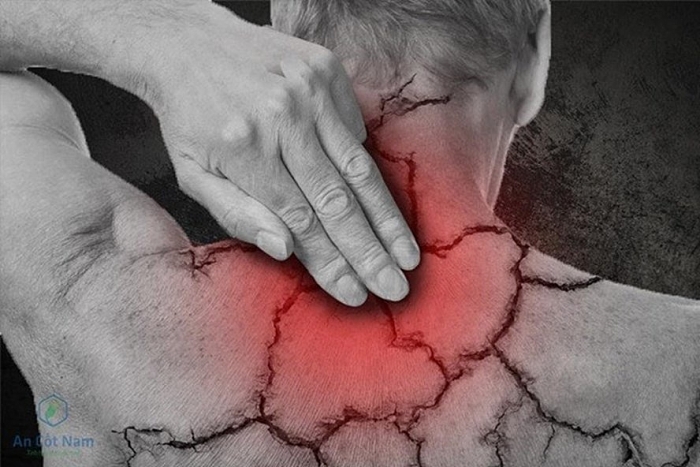 chua dau vai gay tai nha va nhung bai thuoc nam hieu qua