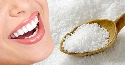 Mẹo làm trắng răng đơn giản hiệu quả