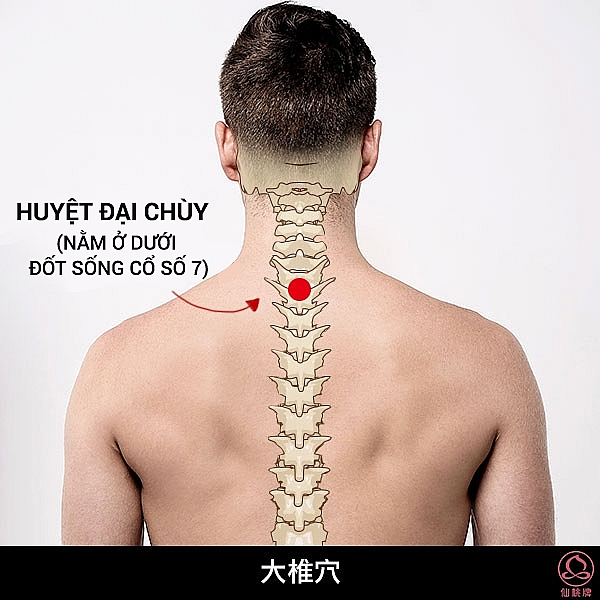 chua chay mau cam bang phuong phap bam huyet