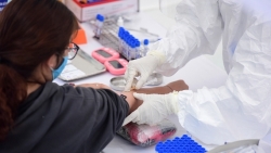 khong cho phep xet nghiem covid 19 theo yeu cau