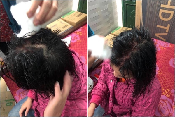 lam toc don tet het 500 nghin nguoi vo bi chong danh va dam keo vao dau