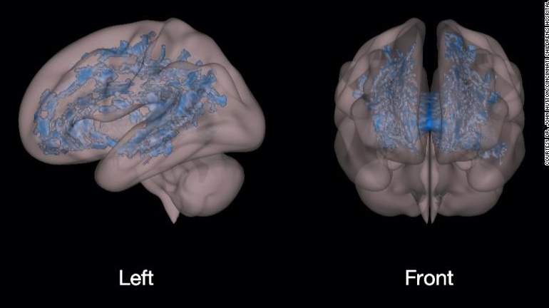 hinh anh khac biet giua nao bo cua tre doc sach va tre xem dien thoai