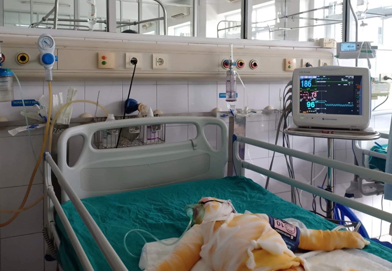 vu 3 tre mam non bi bong suc khoe tien luong rat xau