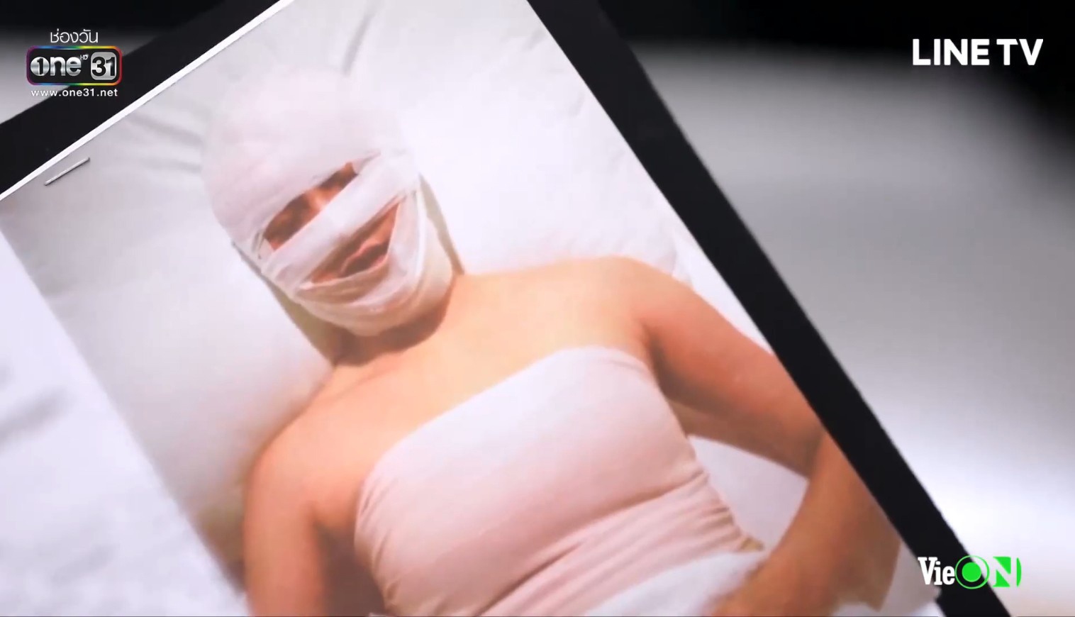 chiec la cuon bay tap 20 ong chom co trong tay ho so benh an cua nira